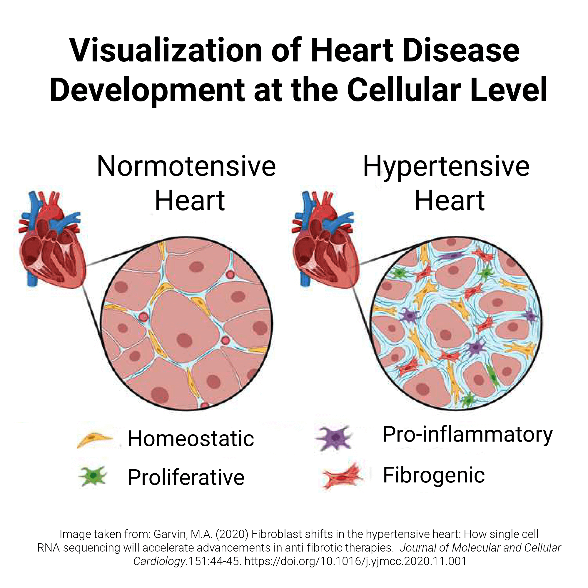Visualization of Heart Disease Development at Cellular Level