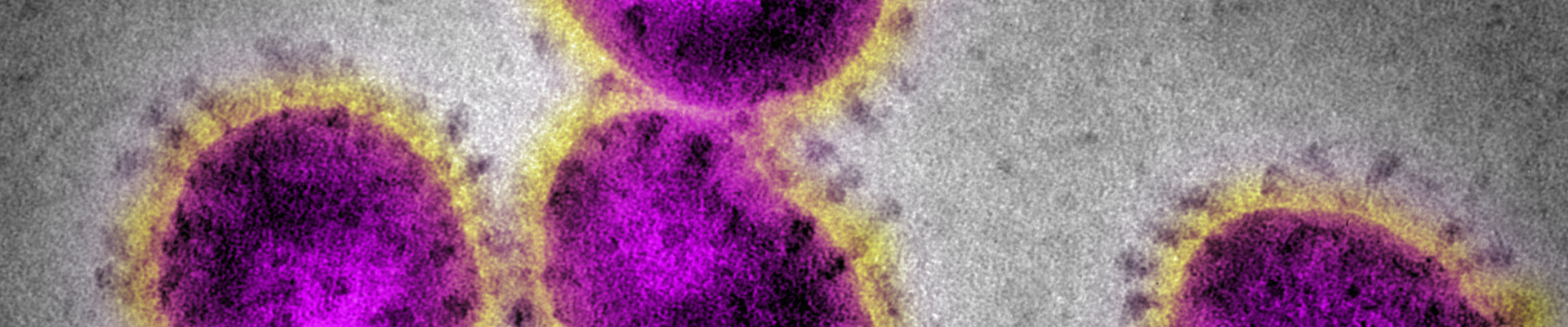 Respiratory virus