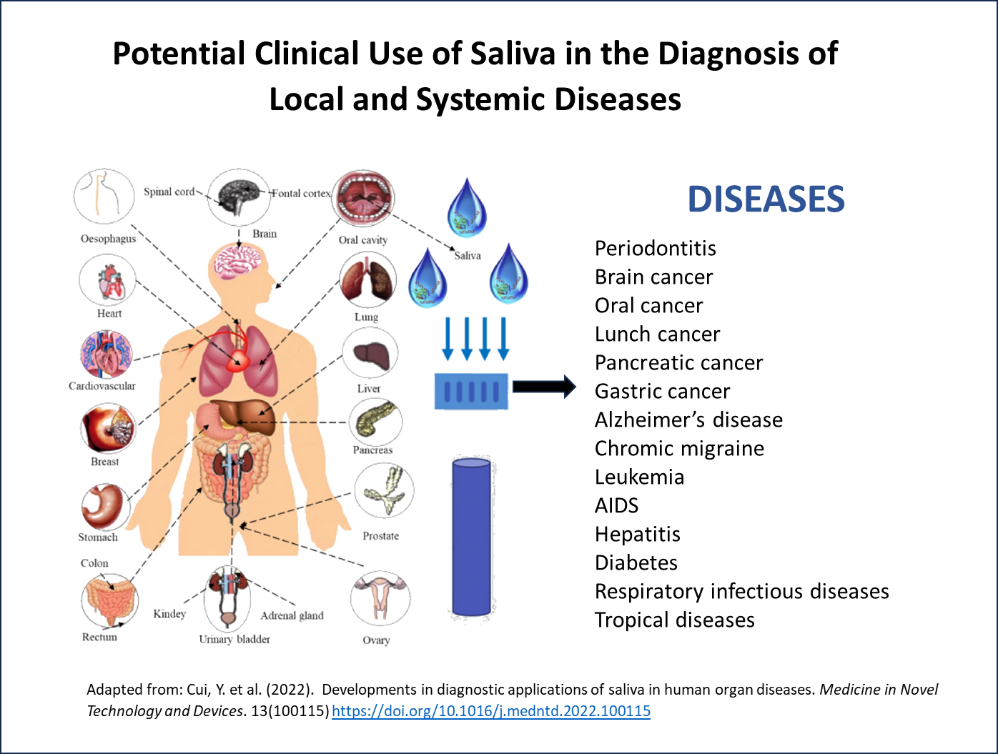 Potential Clinical Use of Saliva in the Diagnosis of Local and Systemic Diseases