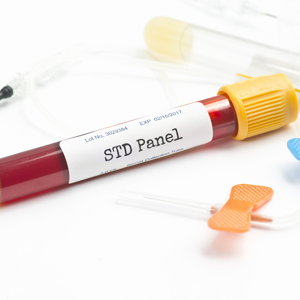 The increasing prevalence of STDs and the need for efficient